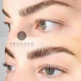 ανόρθωση φρυδιών πριν και μετά brow lamination