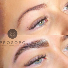 φρύδια με όγκο πριν και μετά brow lamination