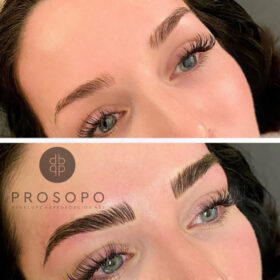 microblading χαλάνδρι πριν και μετά