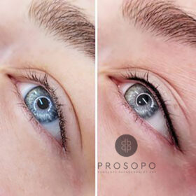 ημιμόνιμο eyeliner πριν και μετά αποτέλεσμα