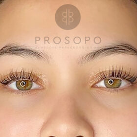 lash lift Χαλάνδρι