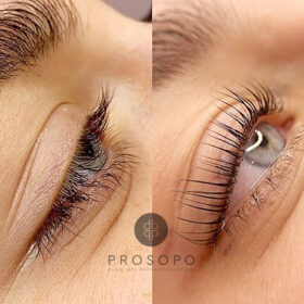 lash lift Χαλάνδρι