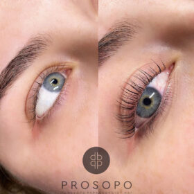 ανόρθωση βλεφαρίδων πριν και μετά lash lift